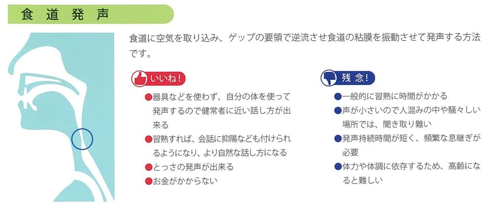 食道発声法の仕組みを解説した図
食道に空気を取り込み、ゲップの要領で逆流させ食道の粘膜を振動させて発声する方法
です。
いい点
・器具などを使わず、自分の体を使って発声するので健常者に近い話し方が出来る
・習熟すれば、会話に抑陽なども付けられるようになり、より自然な話し方になる
・とっさの発声が出来る
・お金がかからない
残念な点
・一般的に習熟に時間がかかる
・声が小さいので人混みの中や騒々しい場所では、聞き取り難い
・発声持続時間が短く、頻繁な息継ぎが必要
・体力や体調に依存するため、高齢になると難しい