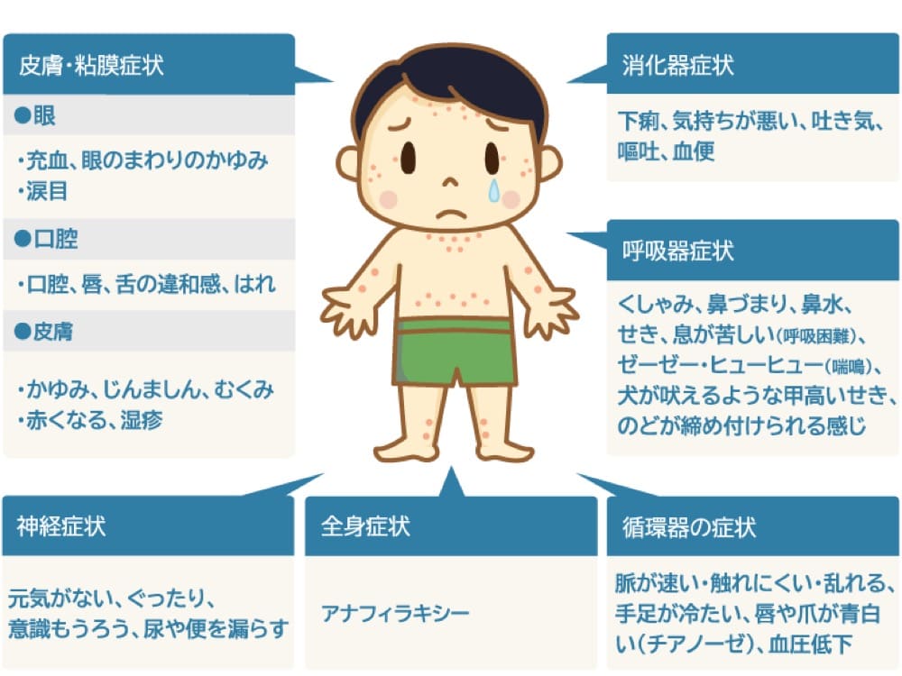 食物アレルギーの症状を説明するイラスト
皮膚・粘膜症状
目
・充血、目のまわりのかゆみ
・涙目
口腔
・口腔、唇、舌の違和感、はれ
皮膚
・かゆみ、じんましん、むくみ
・赤くなる、湿疹
消化器症状
下痢、気持ちが悪い、吐き気
嘔吐、血便
呼吸器症状
くしゃみ、鼻づまり、鼻水、せき、息が苦しい(呼吸困難)、ゼーゼー・ヒューヒュー(喘鳴)、犬が吠えるような甲高いせき、のどが締め付けられる感じ
神経症状
元気がない、ぐったり、意識もうろう、尿や便を漏らす
循環器の症状
脈が速い・触れにくい・乱れる、手足が冷たい、唇や爪が青白い(チアノーゼ)、血圧低下
全身症状
アナフィラキシー